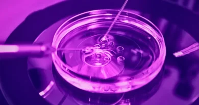 Explain IVF process