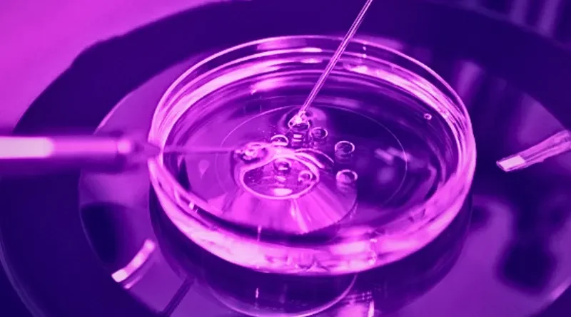 Explain IVF process
